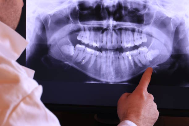 Best Emergency Dentist for Knocked-Out Tooth in Waurika, OK