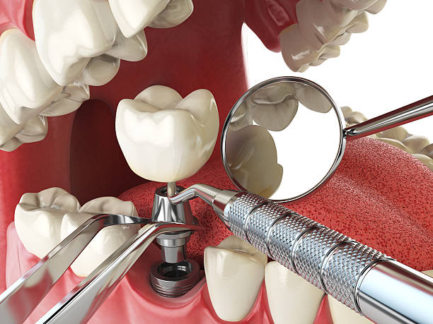 Best Emergency Dental Care for Abscessed Tooth in Waurika, OK